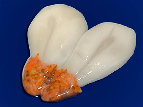 Sübye Yumurtası